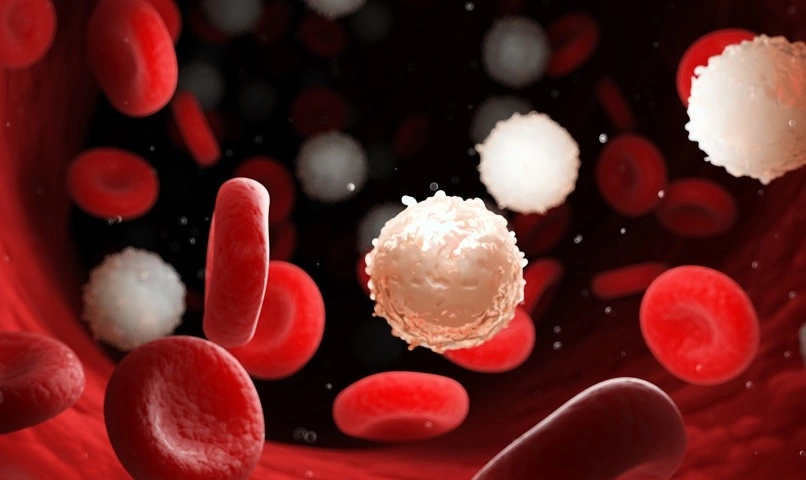 La anemia como signo de  a para enfermedades hematológicas graves